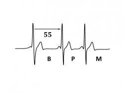 55BPM
